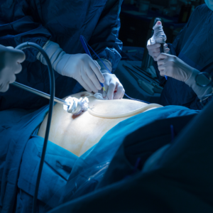 Endoscopic spine surgery