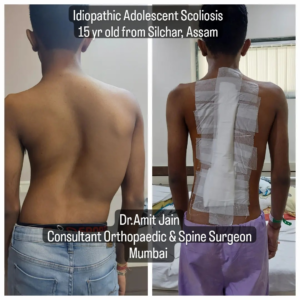 GALLERY - 02 orthospineandphysiorehab mumbai